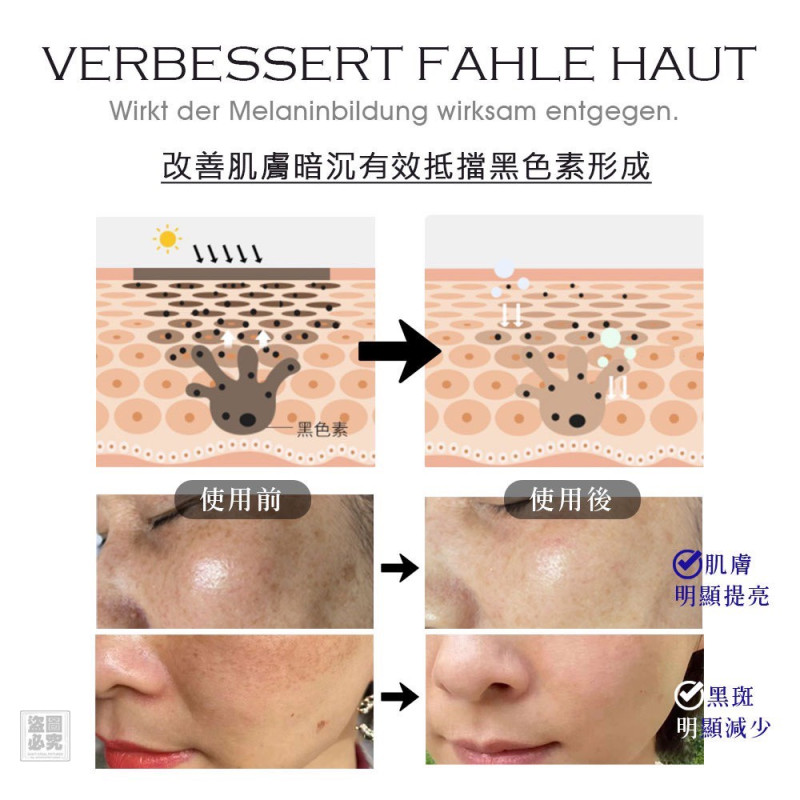 H-德國原裝 Vom Pullach Hof 淡斑修護霜