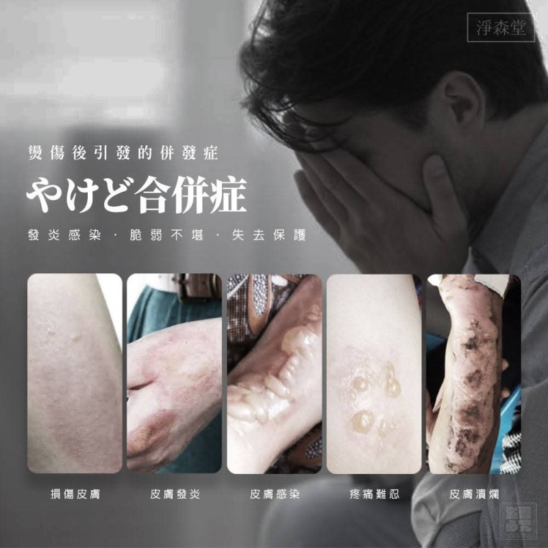 H-祖傳老秘方 冰芯膏